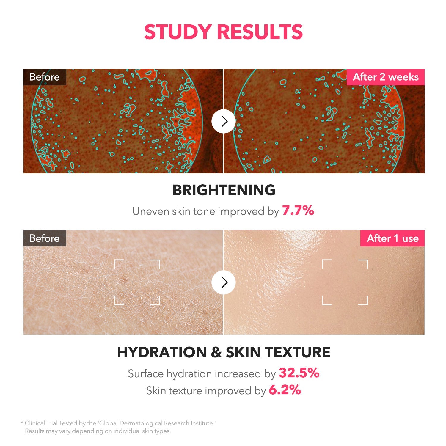 APRILSKIN TXA Niacinamide 99 Milky Toner - rozjaśniający tonik mleczny do twarzy z kwasem traneksamowym 150 ml