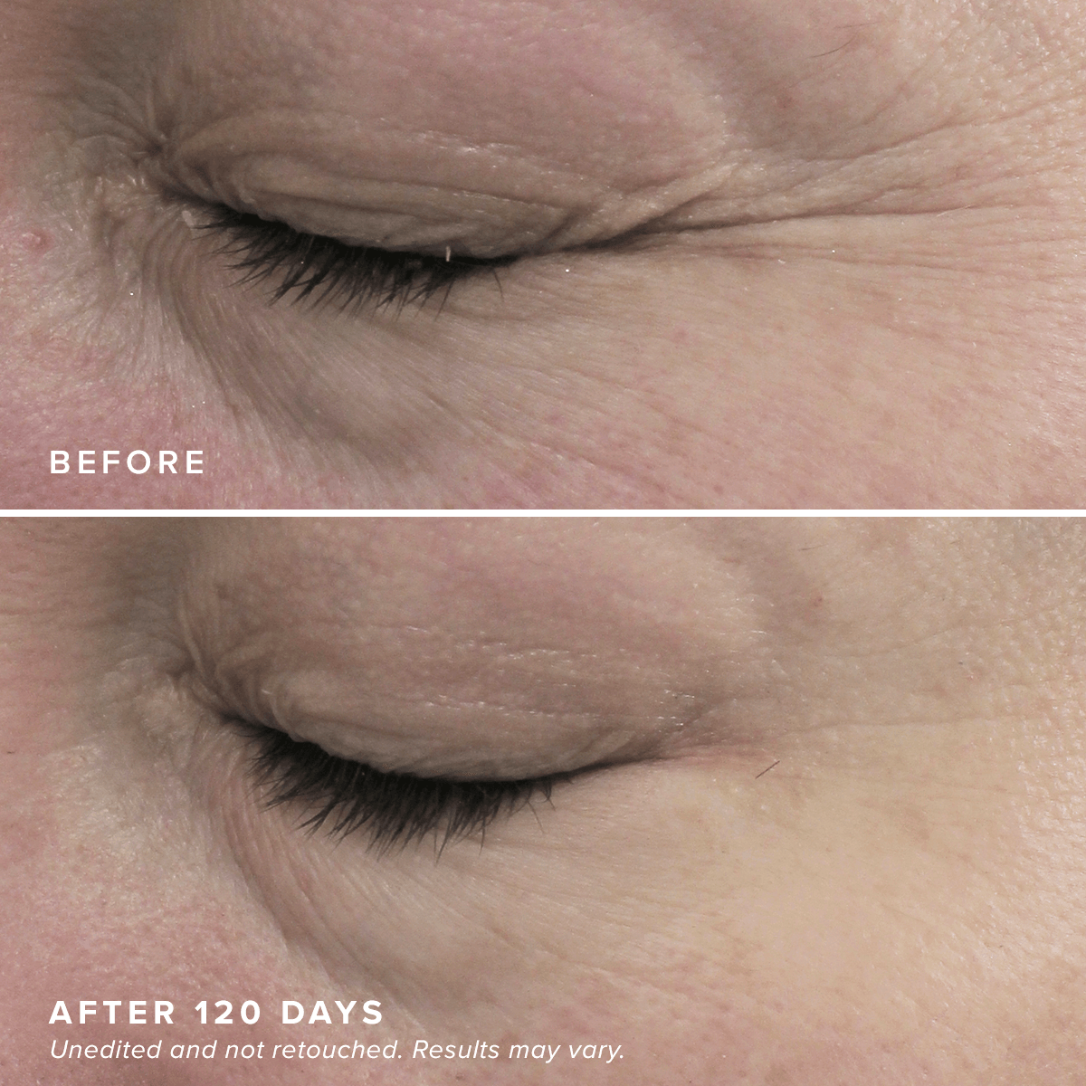 DRMTLGY HPR Eye Cream - przeciwstarzeniowy krem pod oczy z retinoidem HPR nowej generacji 15 ml