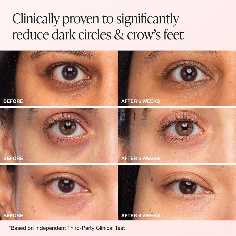 iNNBEAUTY PROJECT Bright & Tight Eye Cream - rozjaśniający krem pod oczy z witaminą C i kwasem traneksamowym 15 ml