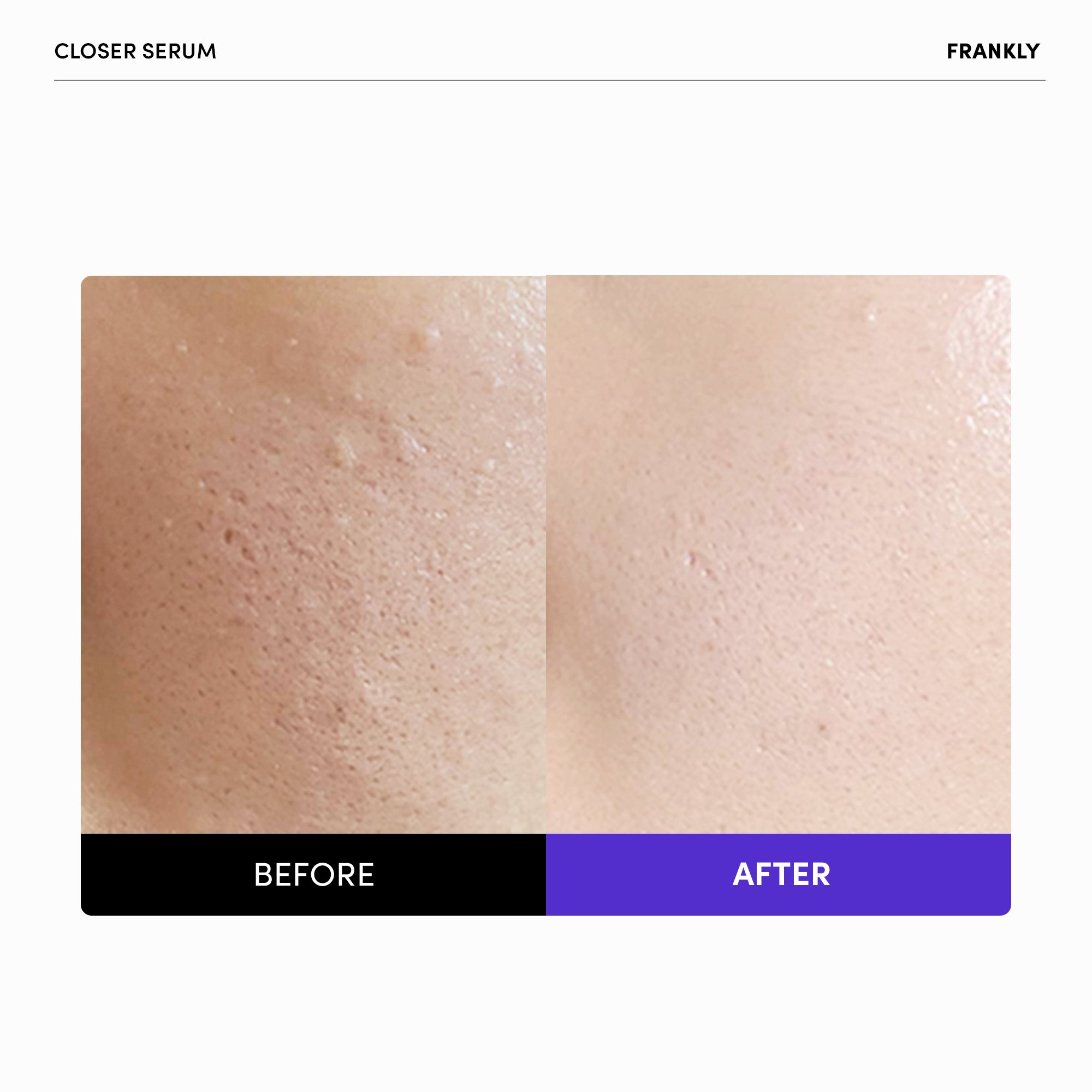 Frankly Closer Pore Reducing Serum 60ml