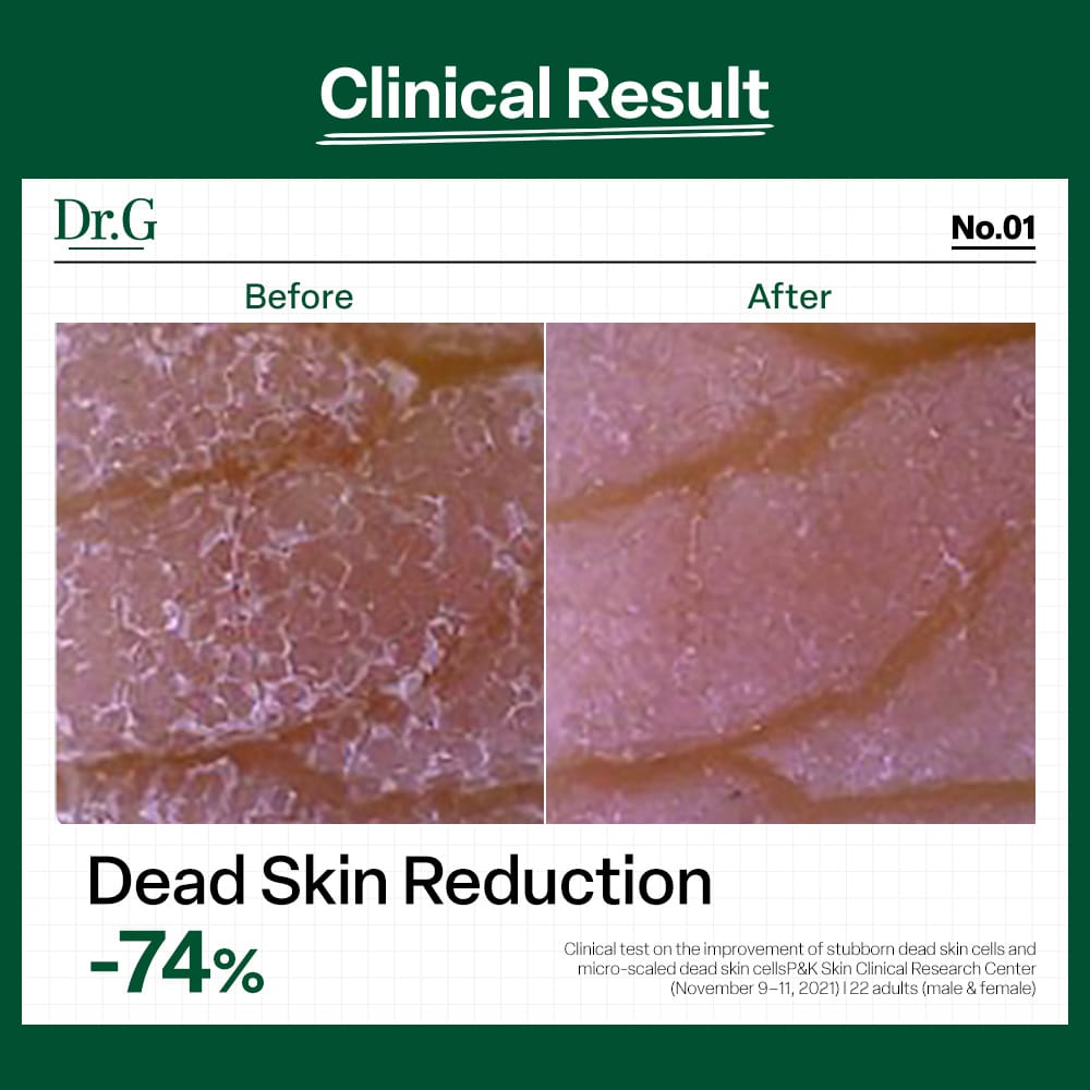 Dr.G Brightening Peeling Gel 120ml