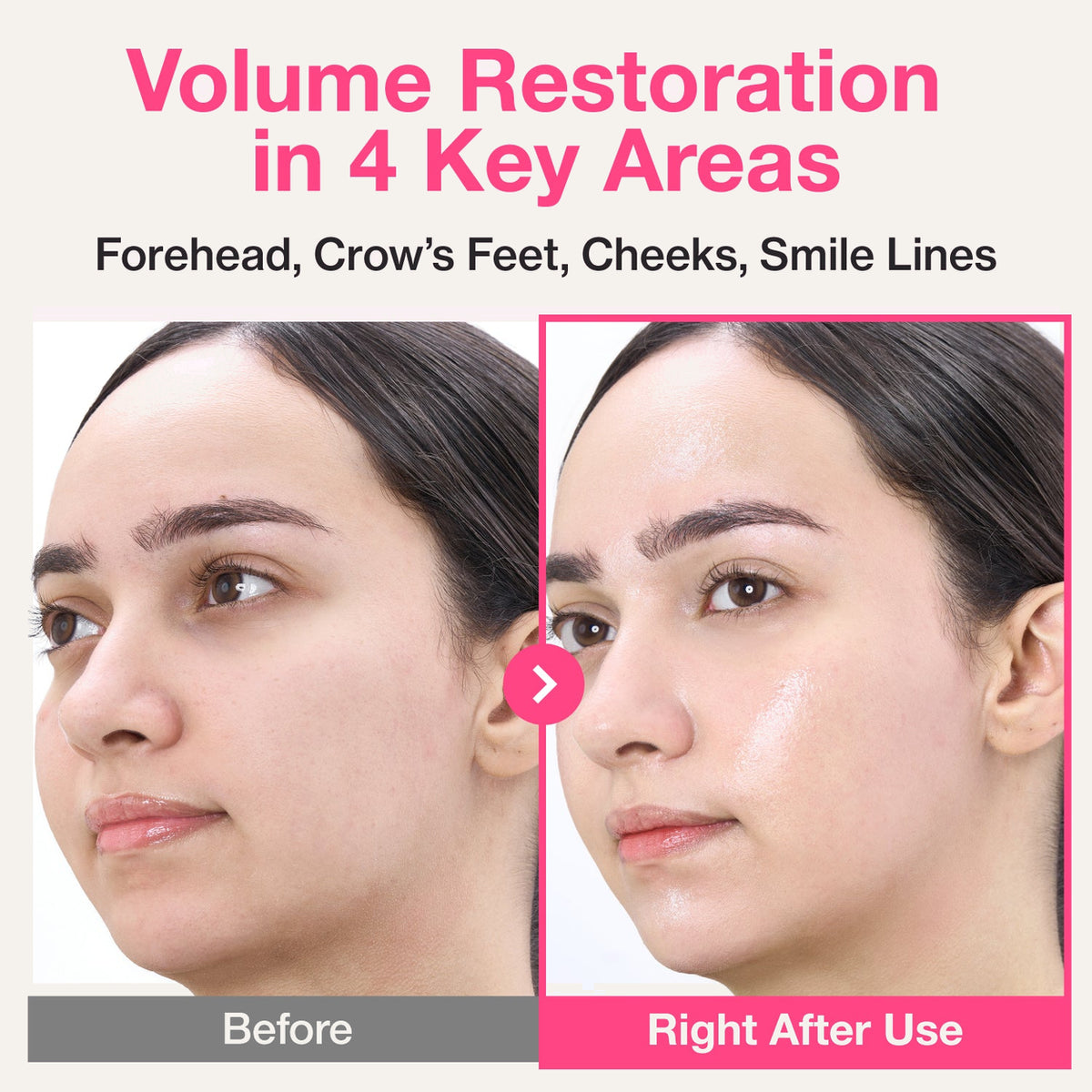 numbuzin No.2 Rose PDRN Collagen Plumping Sheet Mask - wypełnienie skóry przed i po użyciu maski | Ellemania