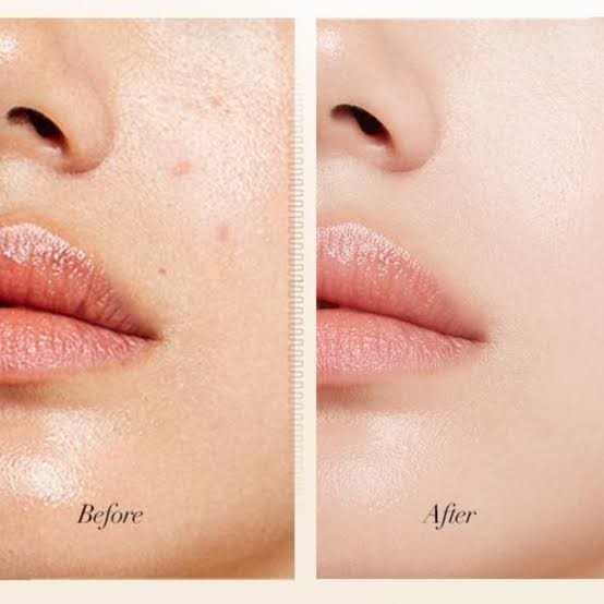 Porównanie cery przed i po użyciu nawilżającego podkładu UODO Moisturizing Light Foundation od ellemania