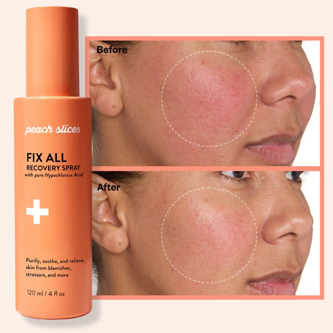 Peach Slices Fix All Recovery Spray — Kojąca mgiełka do twarzy i ciała 120 ml — KANDYDAT (scrap)